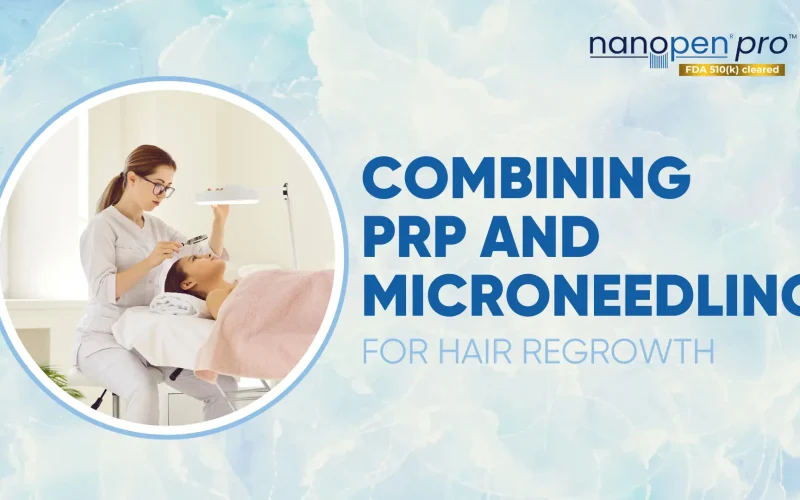 Combining-Microneedling-and-PRP-for-Acne-Scar-Treatment-1 Combining-Microneedling-and-PRP-for-Acne-Scar-Treatment-1
