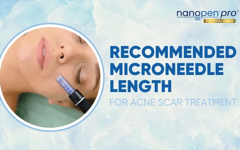 Recommended-Microneedle-Length-for-Acne-Scar-Treatment Recommended-Microneedle-Length-for-Acne-Scar-Treatment