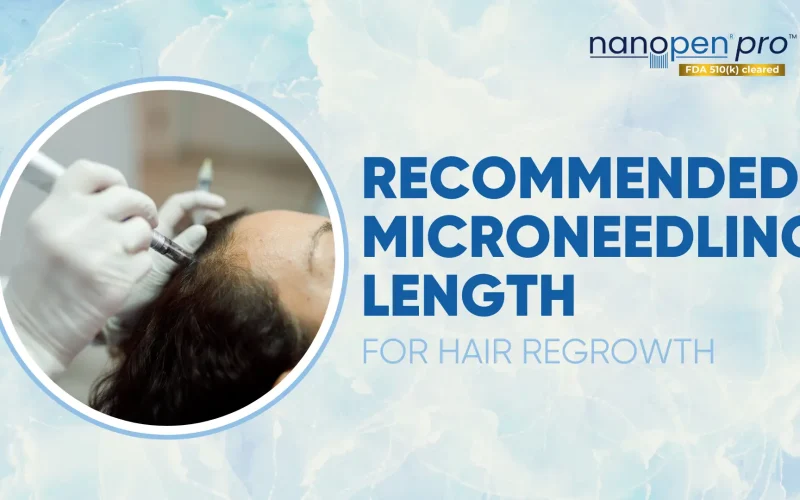 Recommended-Microneedling-Length-for-Hair-Regrowth