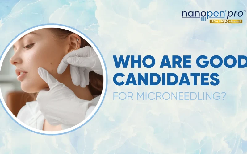 Who-are-Good-Candidates-for-Microneedling